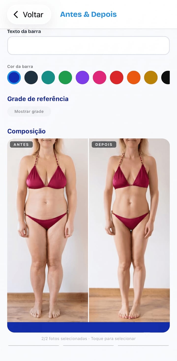Antes e depois de procedimento corporal no PhotoClin