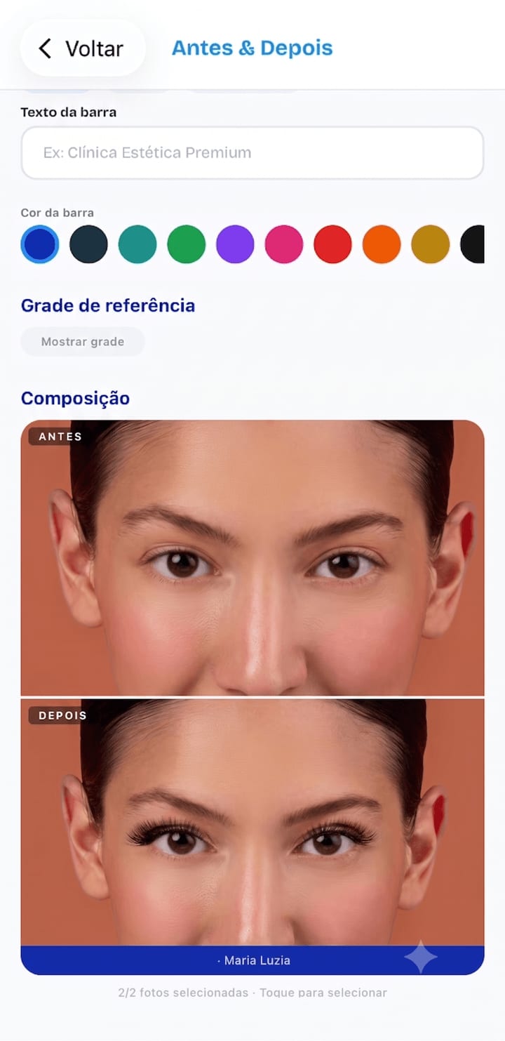 Antes e depois de procedimento facial no PhotoClin